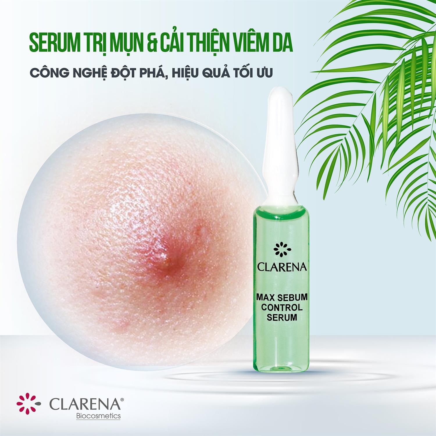 ĐIỆN DI TINH CHẤT NGĂN NGỪA MỤN