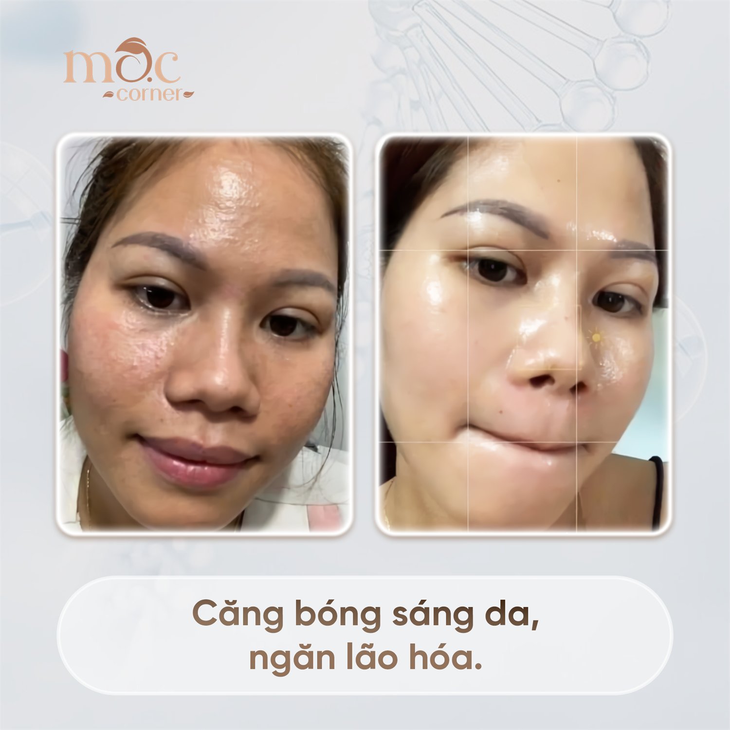 KHIẾN CHỒNG MÊ NHƯ ĐIẾU ĐỔ KHI ĐẾN LÀM CĂNG BÓNG DA TẠI MỘC CORNER 
